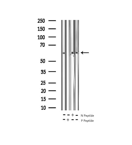 MAP3K8 / TPL2 Antibody (phospho-Thr290)