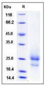 Mouse TSLP Protein (Recombinant His,C-terminus)