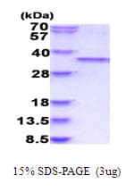 Human CDK1 / CDC2 Protein (Recombinant His)