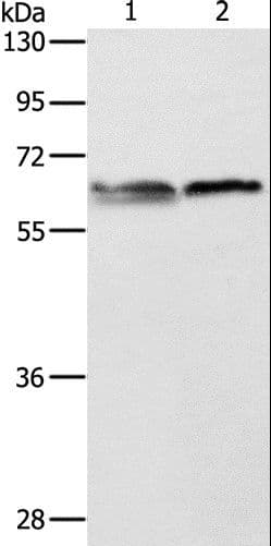 ALAS2 Antibody