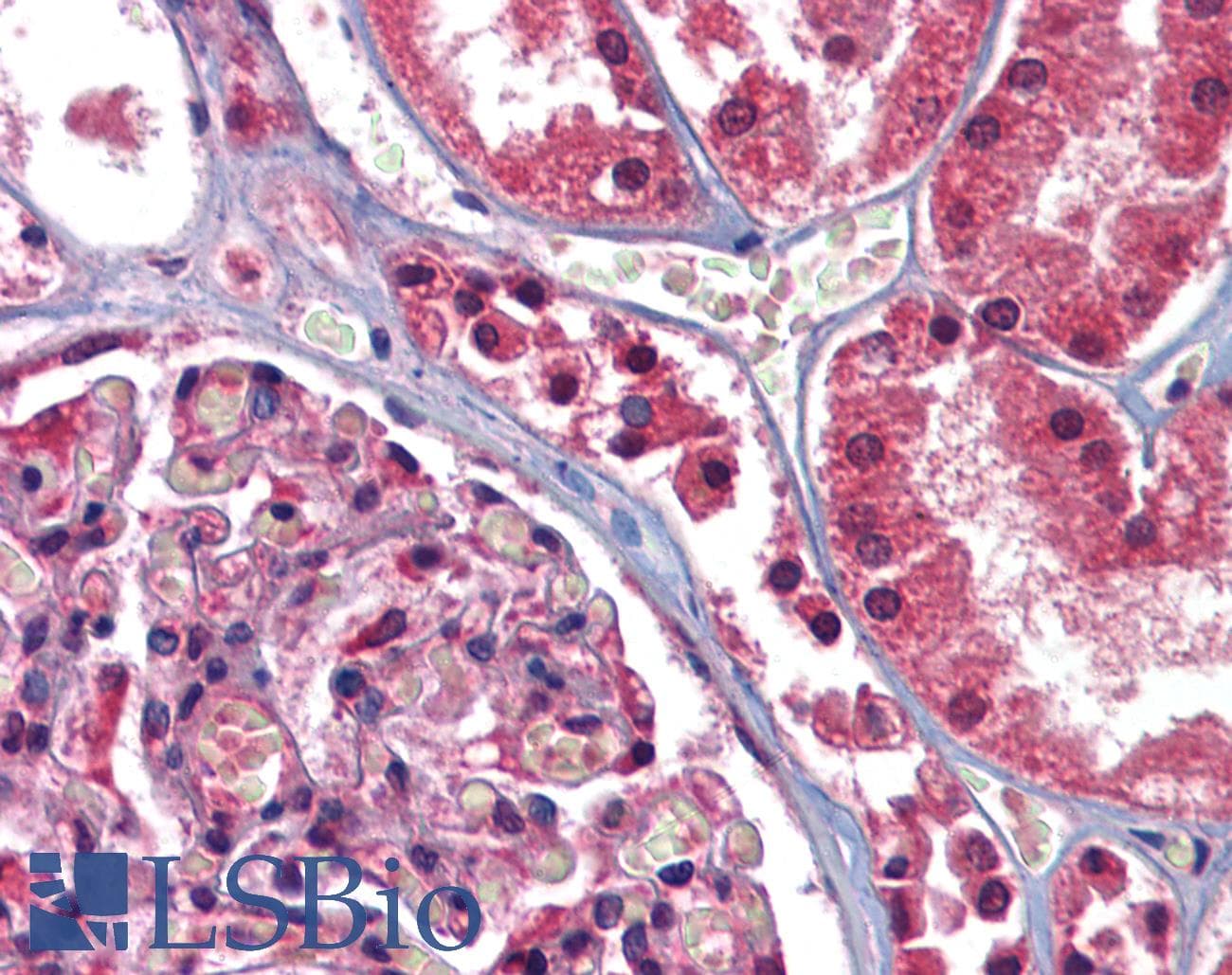 IHC-plus™ GFPT1 / GFAT Antibody (N-Terminus)