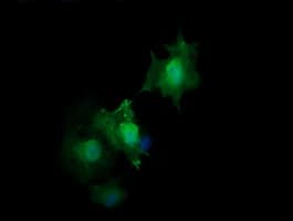 HRAS / H-Ras Antibody (clone OTI2A1)
