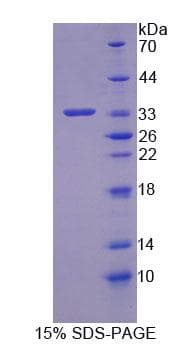 Human OSBP Protein (Recombinant His-T7, N-terminus)