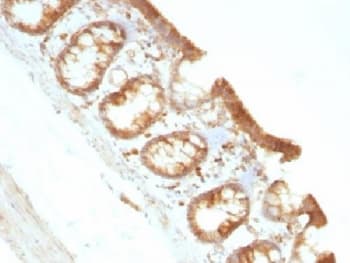 MSN / Moesin Antibody (clone MSN/491)