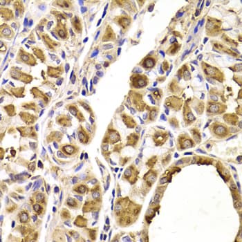 Polyclonal Rabbit anti-Human SEPT2 / Septin 2 Antibody (IHC, WB)