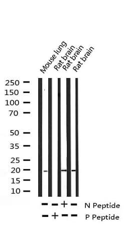 Polyclonal Rabbit anti-Human STMN1 / Stathmin / LAG Antibody (phospho-Ser24, IHC, IF, WB)