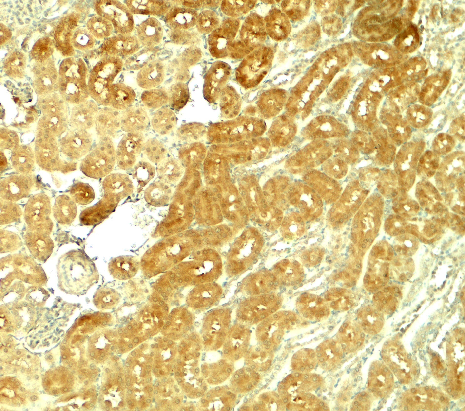 SMURF1 Antibody