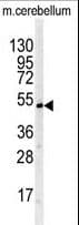 BTBD1 Antibody (aa295-322)