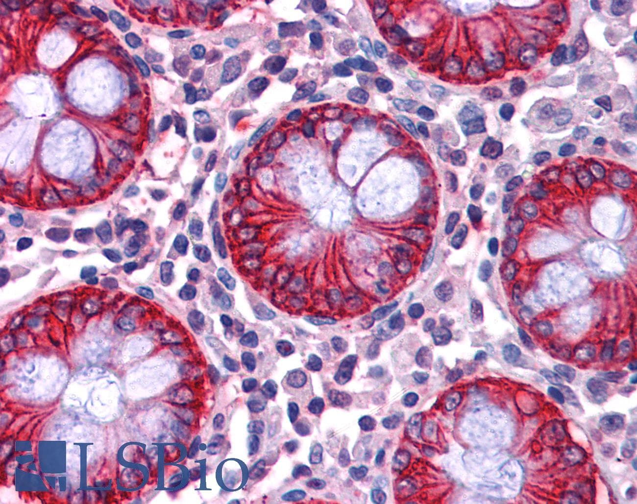 PathPlus™ NDRG1 Antibody (aa382-394)