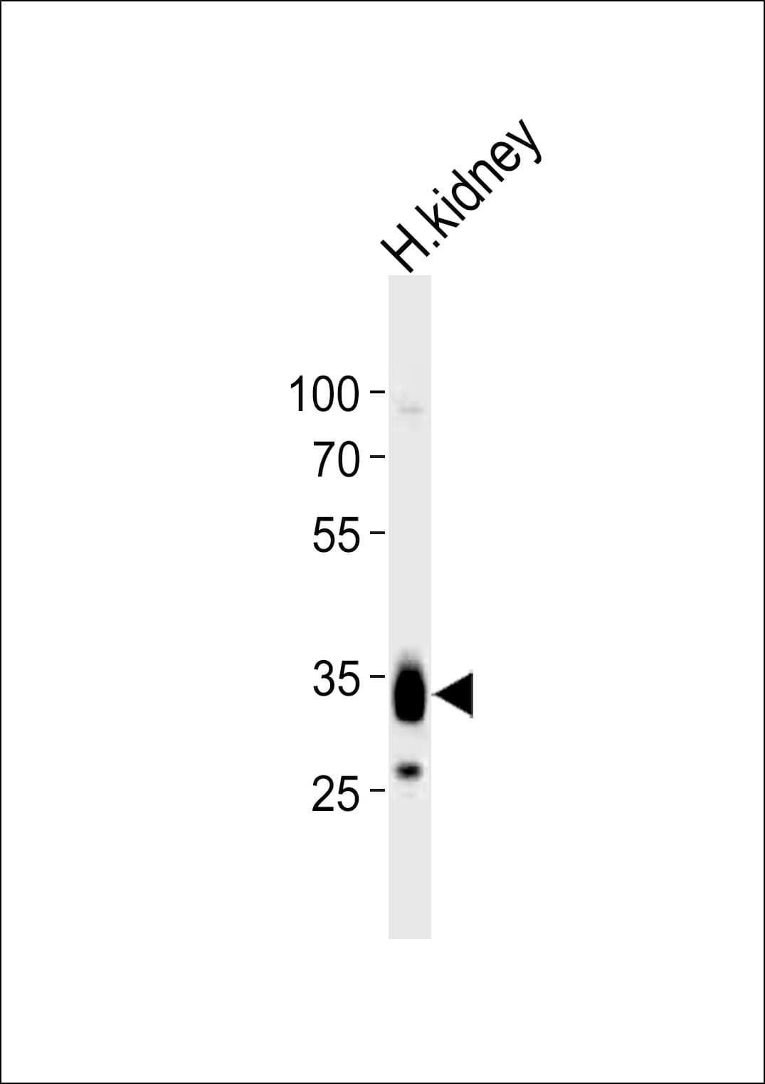 IHC-plus™ Polyclonal Rabbit anti-Human PAP2a / PPAP2A Antibody (aa270-304, IHC, WB)
