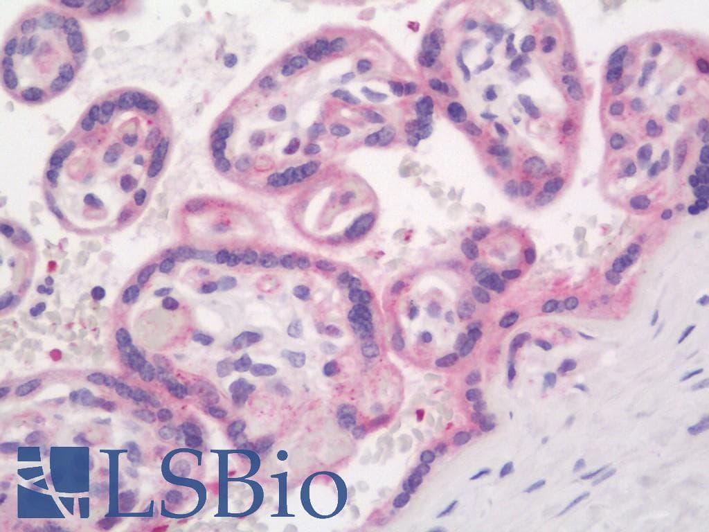 IHC-plus™ Polyclonal Rabbit anti-Human EGFR Antibody (Ser1070, IHC, WB)