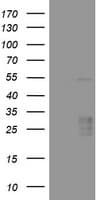 VEGFA / VEGF Antibody (aa206-412, clone OTI2B9)
