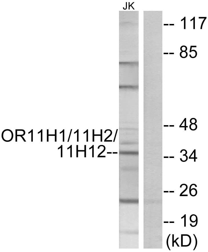 OR11H1+2+12 Antibody (C-Terminus)