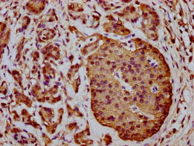 C1orf38 Antibody