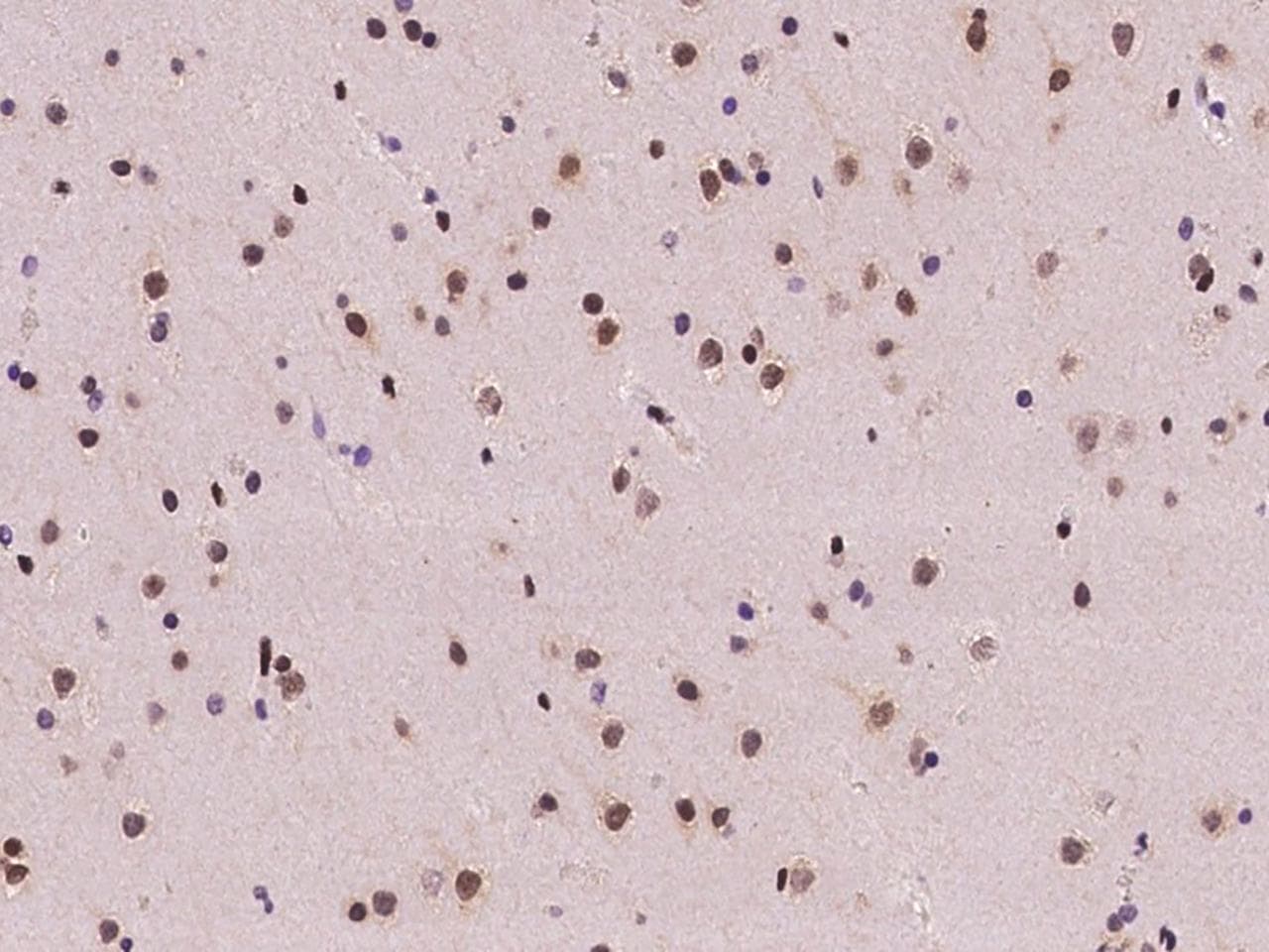 FKBP5 / FKBP51 Antibody