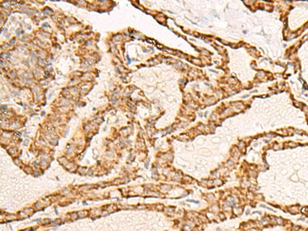 Polyclonal Rabbit anti-Human ATP5I Antibody (IHC, WB)