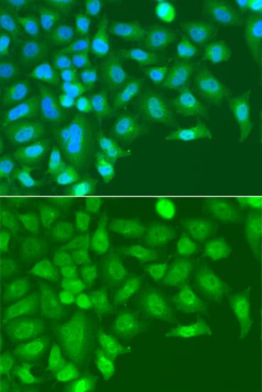 TARBP2 / TRBP2 Antibody