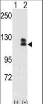 Polyclonal Rabbit anti-Human EPHB2 / EPH Receptor B2 Antibody (IHC, WB)