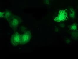 PYCRL Antibody (clone OTI5F7)