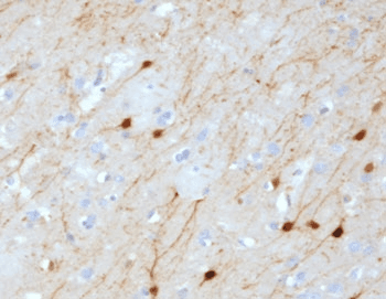Monoclonal Mouse anti-Human CALB2 / Calretinin Antibody (clone CLRT-1, Ready-to-Use, IHC)