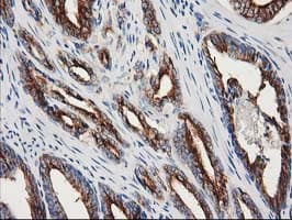 TUBB4 / Tubulin Beta 4 Antibody (clone 3C12, Carrier-free)