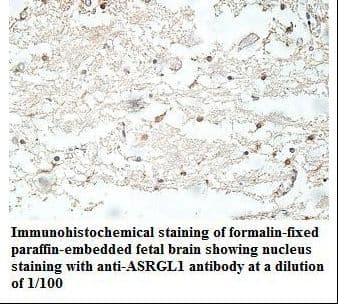 Polyclonal Rabbit anti-Human ASRGL1 Antibody (aa2-180, IHC, WB)