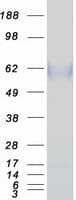 Human CD36 Protein (Recombinant Myc-DDK (Flag))