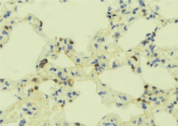 GEM / KIR Antibody