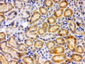 CYP27B1 Antibody