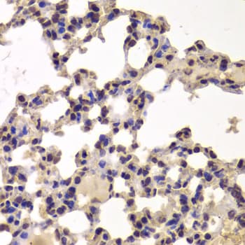 HDAC7 Antibody
