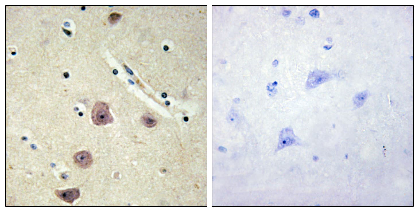 AK5 / Adenylate Kinase 5 Antibody (aa391-440)