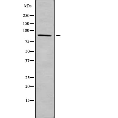 Polyclonal Rabbit anti-Human ADAM28 Antibody (WB)