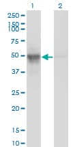 BAF53 / ACTL6A Antibody (clone 3C4)