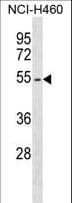 EPOR / EPO Receptor Antibody (aa329-357)