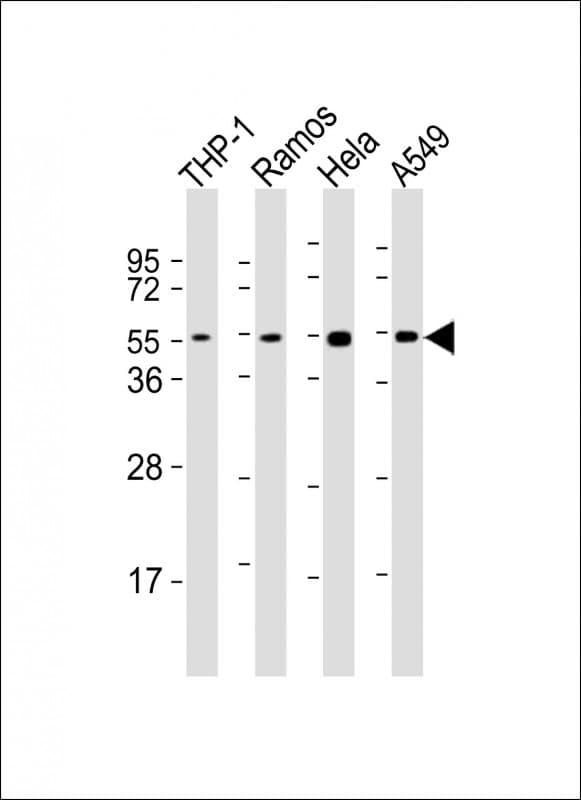 Polyclonal Rabbit anti-Human MAP2K7 / MEK7 Antibody (aa363-396, WB)