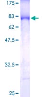 Human IKBKG / NEMO / IKK Gamma Protein (Recombinant GST)