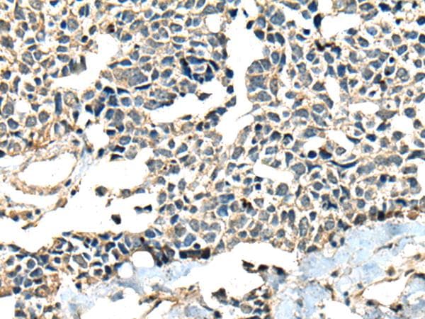 Polyclonal Rabbit anti-Human CALHM1 Antibody (IHC)