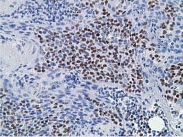 HOXC11 Antibody (clone OTI4B8)