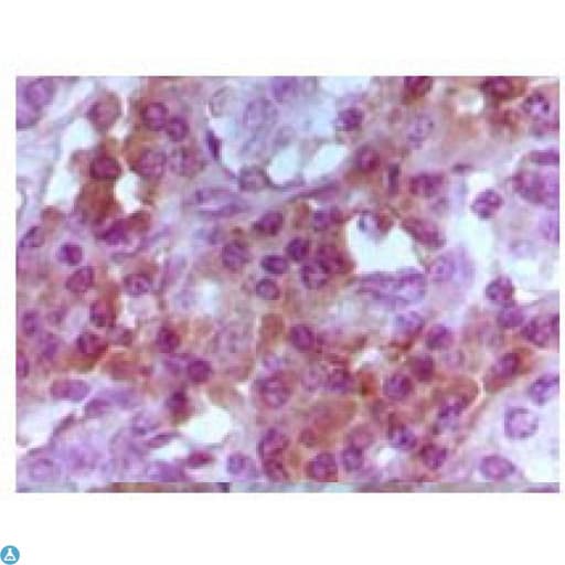 FOXP3 Antibody