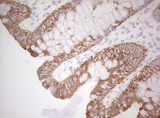 Basic Cytokeratin AE3 Antibody (clone AE3)