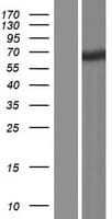 TTC39A Protein (Over-Expression Lysate Myc-DDK (Flag))