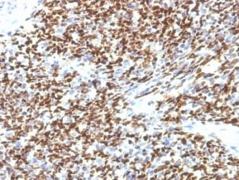 Monoclonal Mouse anti-Human PAX7 Antibody (clone SPM613, aa300-600, IHC)
