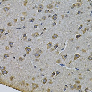 CYP17 / CYP17A1 Antibody