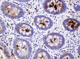 TAG-72 Antibody (clone CC49)