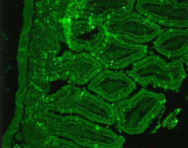 Polyclonal Rabbit anti-Rat SSTR2 Antibody (C-Terminus, IHC, IF, WB)