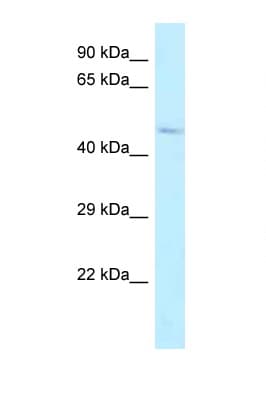 Polyclonal Rabbit anti-Human ALDH3B2 Antibody (aa216-265, WB)
