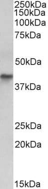 IHC-plus™ KRT19 / CK19 / Cytokeratin 19 Antibody (aa285-298)