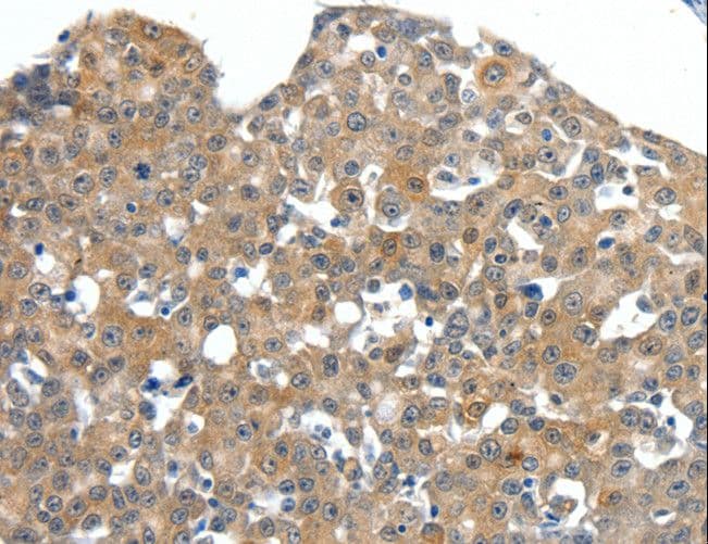 Polyclonal Rabbit anti-Human SCN11A / Nav1.9 Antibody (IHC)