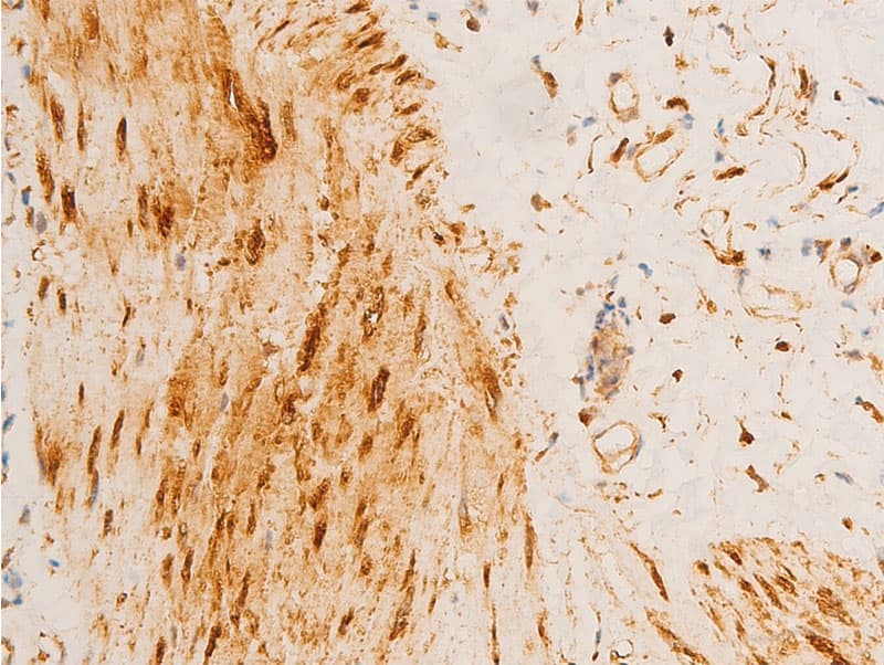 HSPB6 / HSP20 Antibody (phospho-Ser16)
