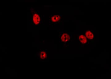 Polyclonal Rabbit anti-Human TIGD3 Antibody (IHC, IF, WB)
